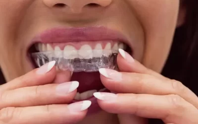 Invisalign Baltimore: Clear Aligner Therapy for Discreet Orthodontic Correction